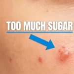 10 Obvious Signs You’re Eating Too Much Sugar – How Many Do You Have?