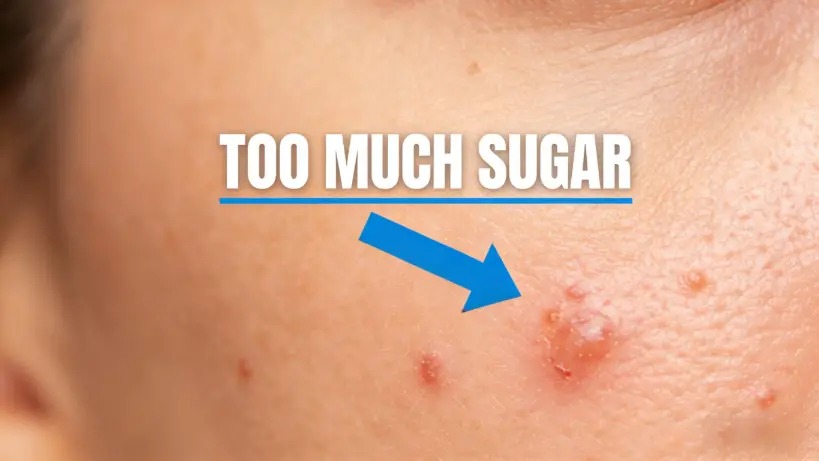 10 Obvious Signs You’re Eating Too Much Sugar – How Many Do You Have?